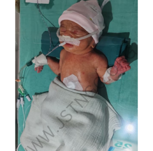 Baby of Snehal Success Story
