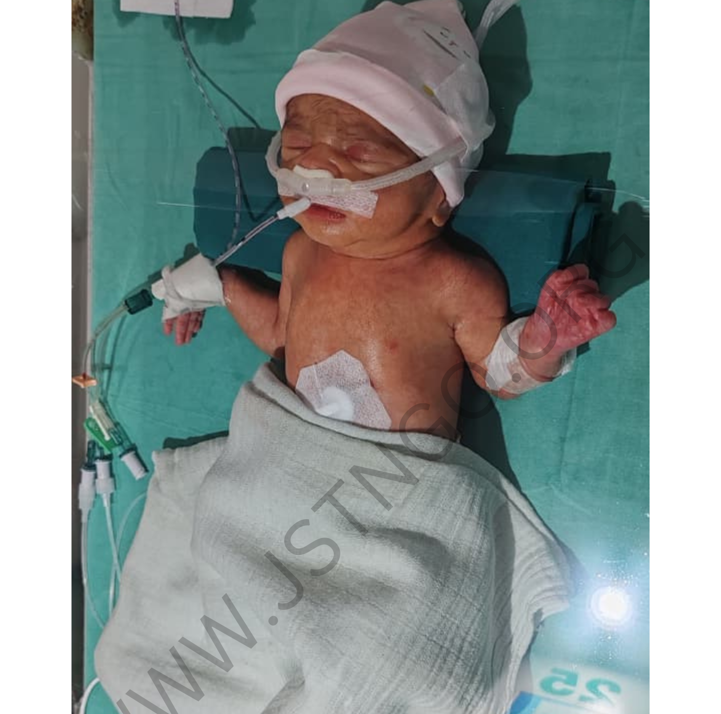 Baby of Snehal Success Story
