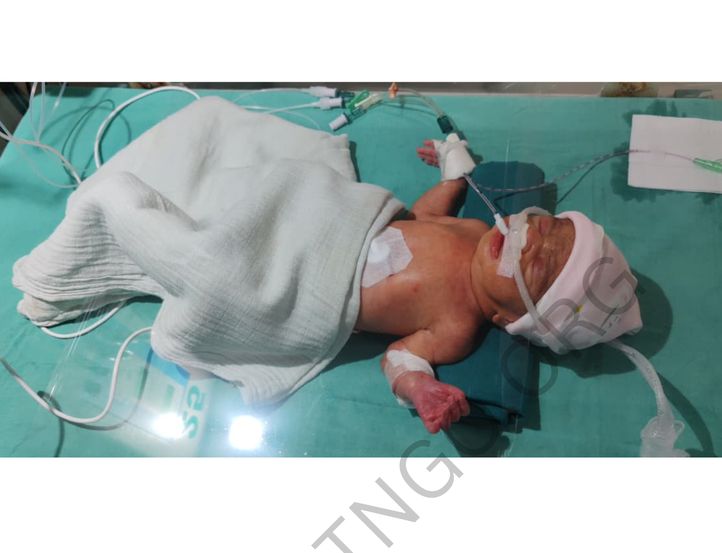 Baby of baby-of-snehal-swapnil-kadam