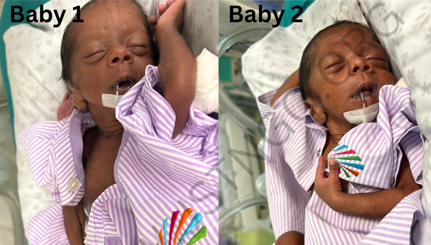 Twin baby of pushpa-photo 